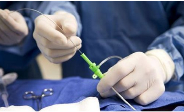 Cirugía Cardiaca Mínimamente Invasiva, nuevo método utilizado en el Hospital Central