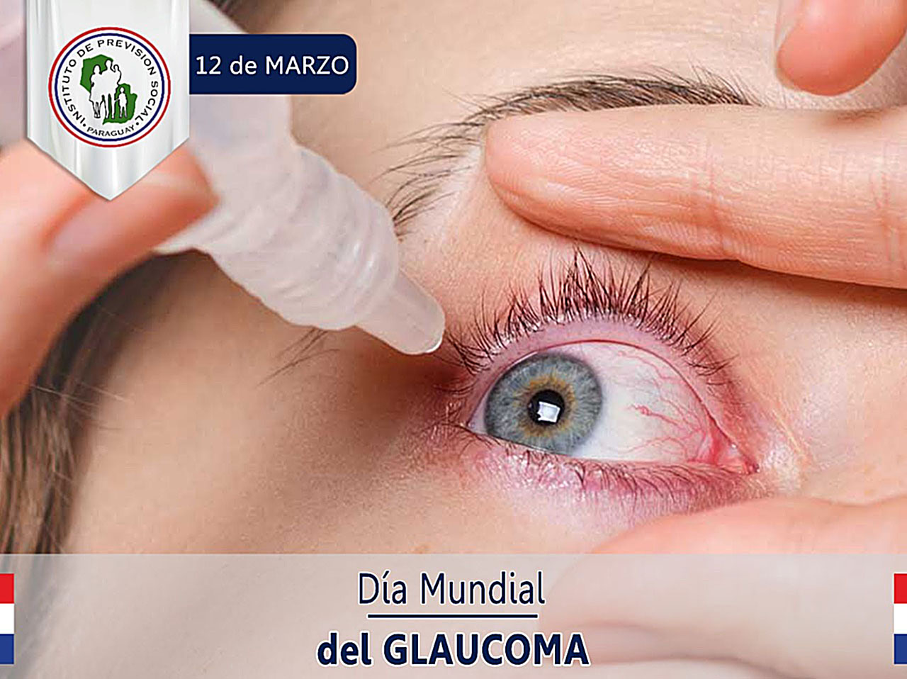 Día Mundial del Glaucoma: Servicio de Oftalmología IPS concientiza con prevención