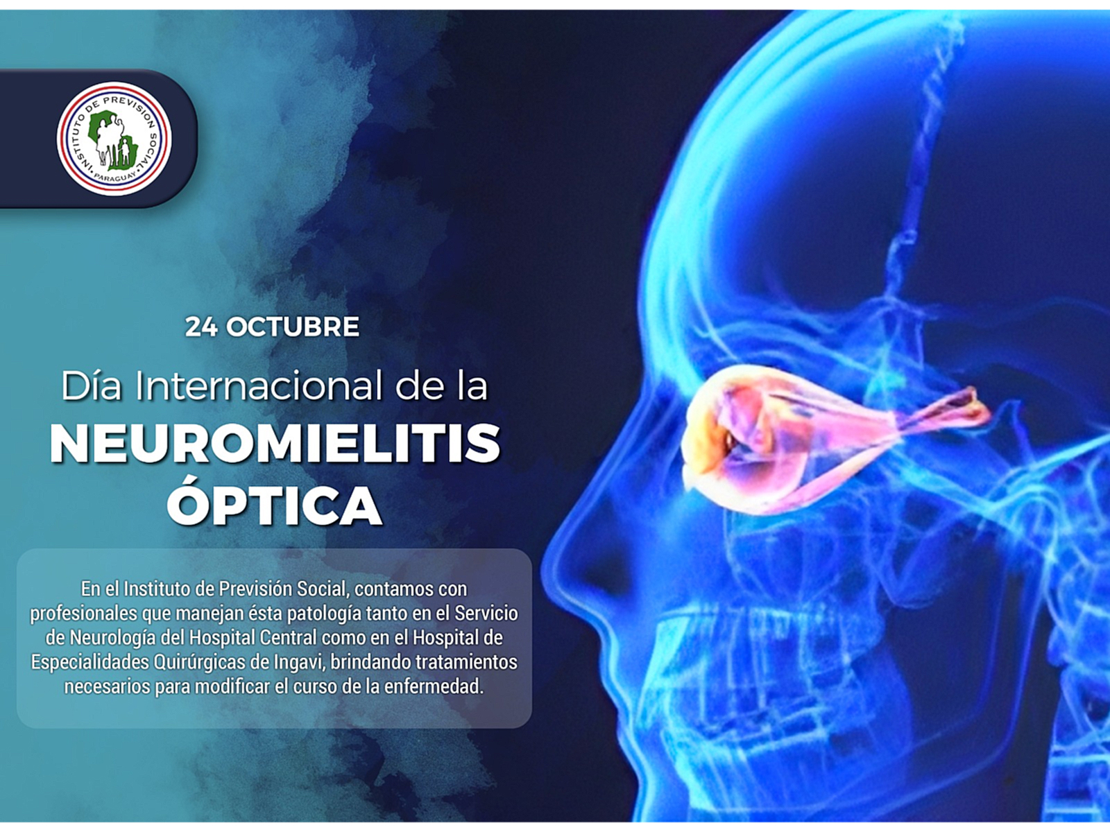 IPS ofrece un tratamiento multidisciplinario a los pacientes que padecen Neuromielitis óptica