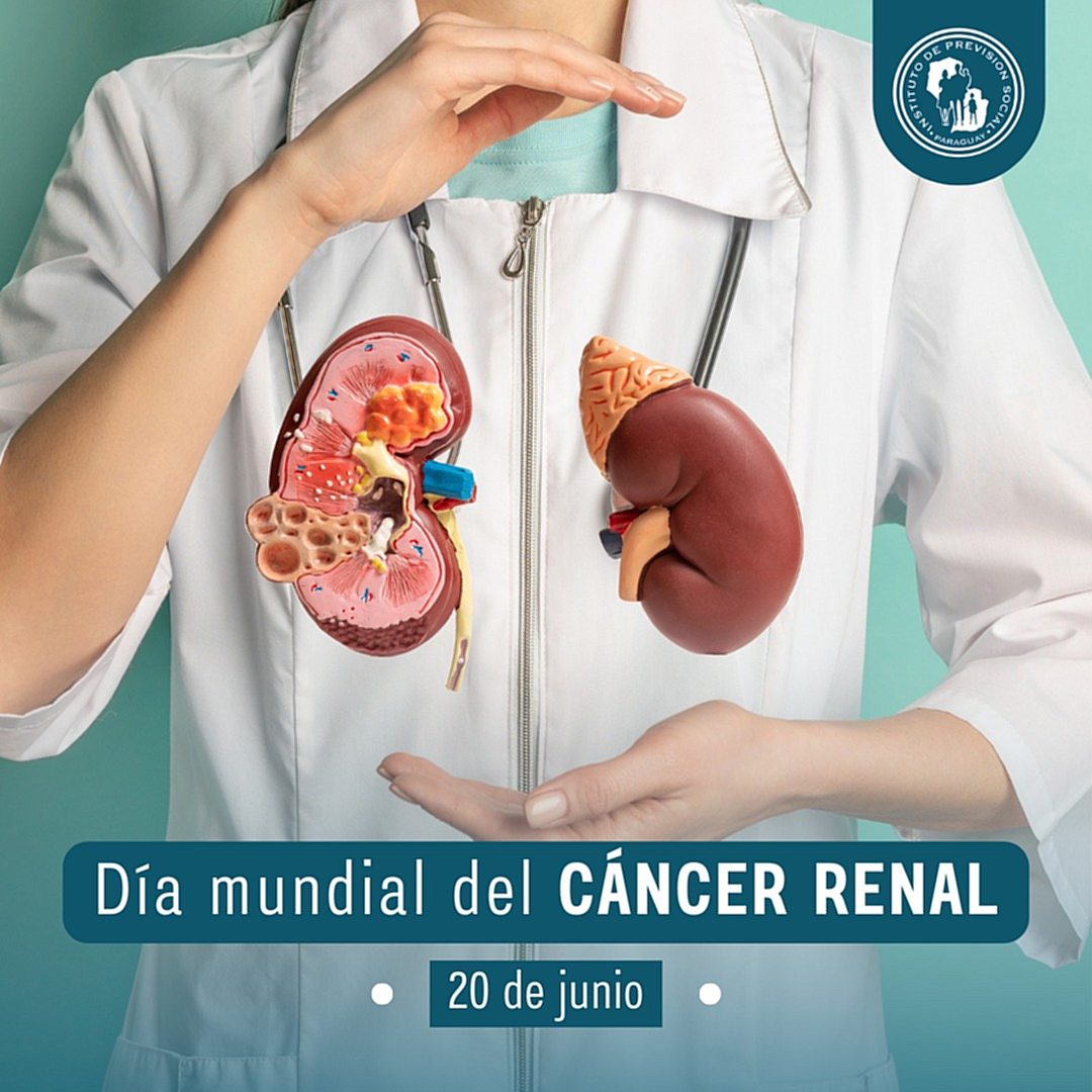 En el Hospital Central, se diagnostica en promedio, a unos 40 nuevos pacientes por Cáncer Renal