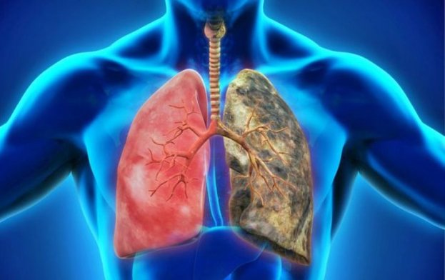 Disminución de la capacidad respiratoria como principal síntoma del EPOC