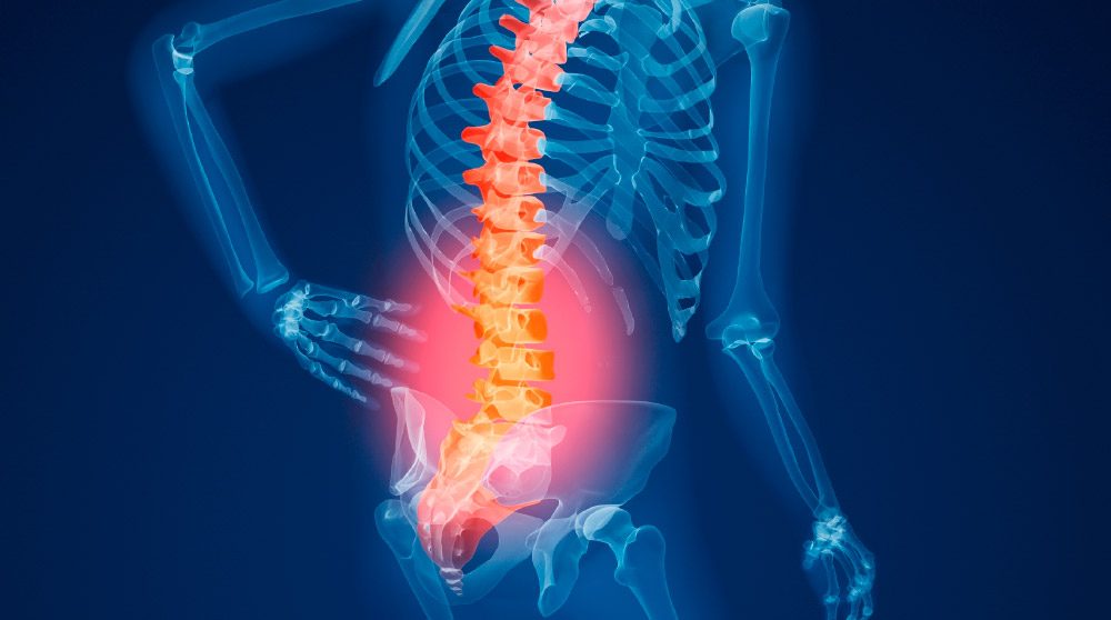 Osteoporosis: un tratamiento temprano puede lograr una mejor calidad de vida