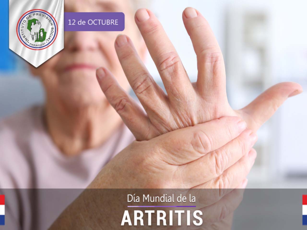Un 30% de los pacientes que asisten al Servicio de Reumatología padecen de artritis reumatoide
