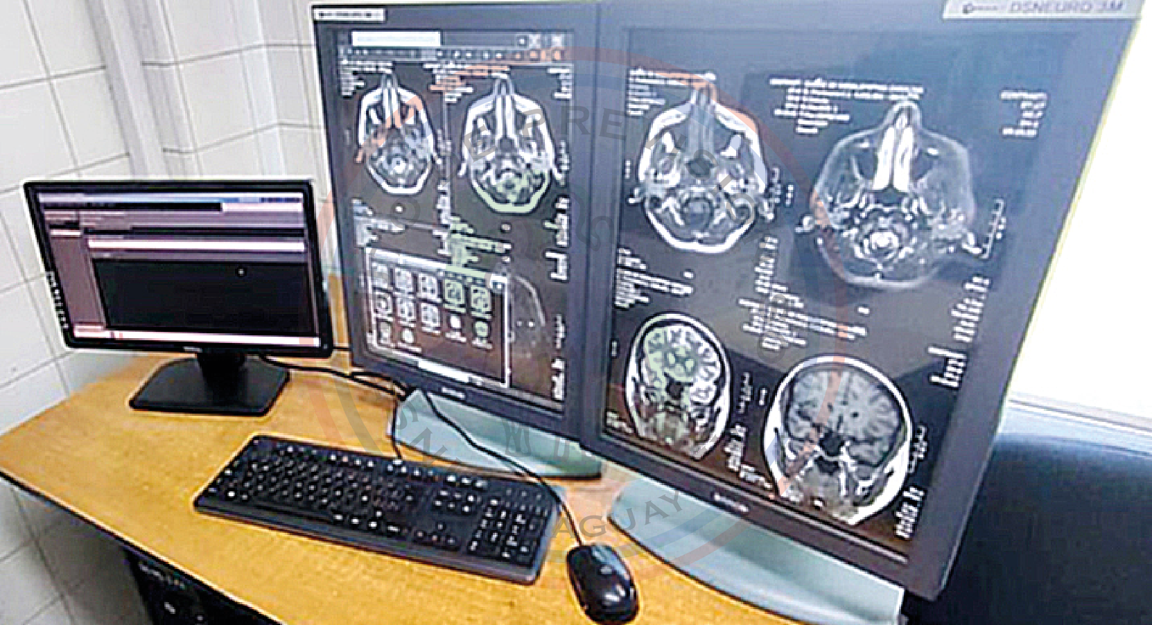 Servicio de Neurología del HCIPS inaugura Sala de Monitoreo Continuo