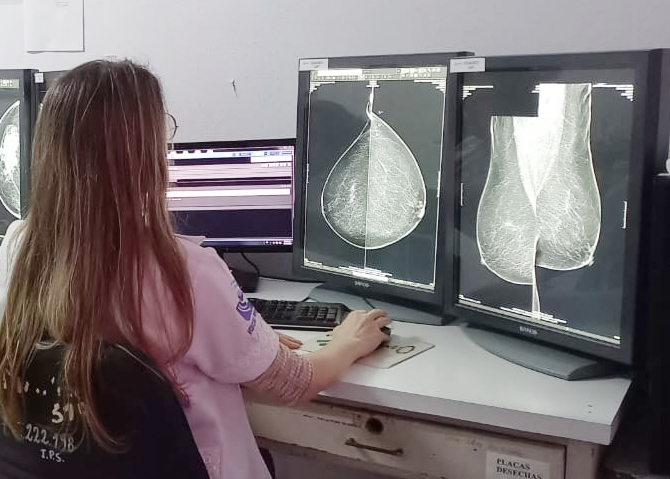La mamografía es el principal estudio para diagnosticar el cáncer de mama