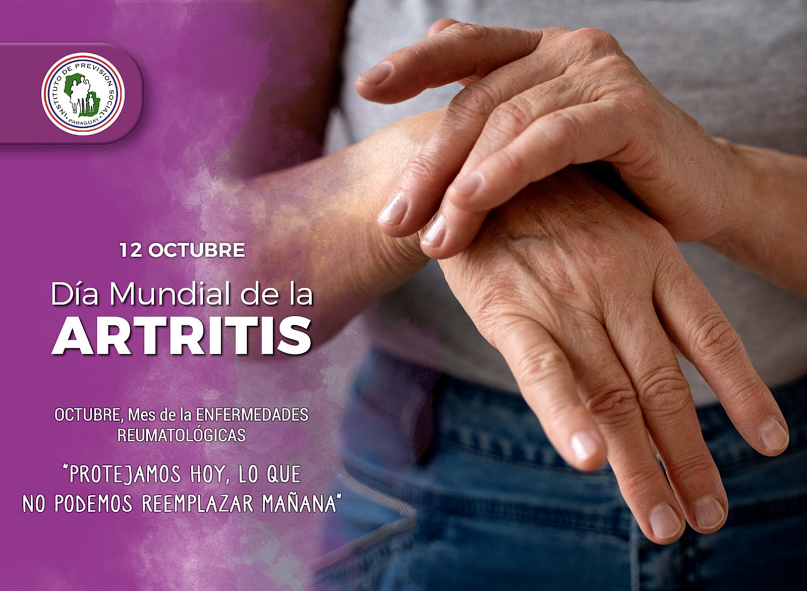 Tratamiento precoz es fundamental para enfrentar artritis reumatoide