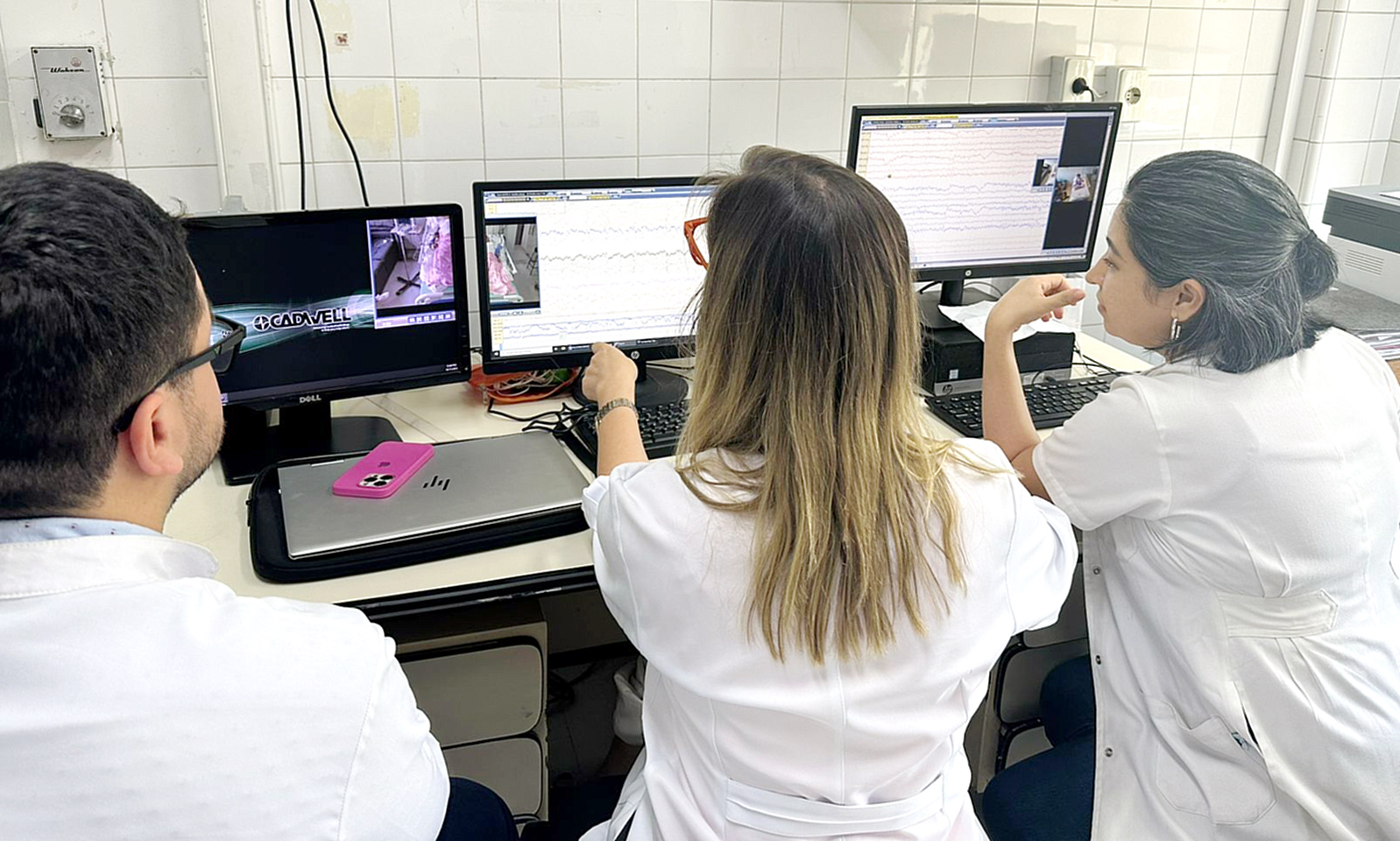 Por primera vez en el país se aplica un sistema de monitorización para pacientes sometidos a cirugía de epilepsia