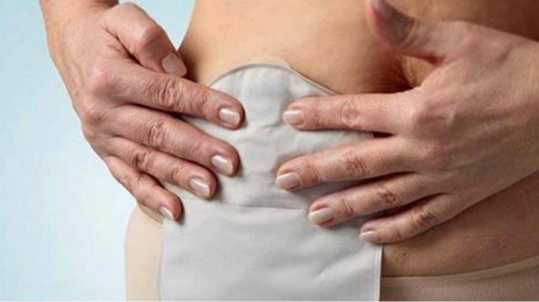 La importancia del acompañamiento a un paciente ostomizado    