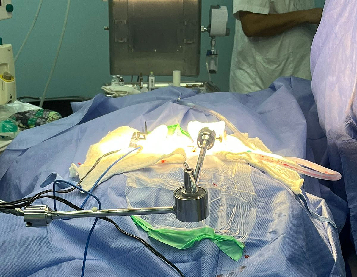 Exitosa cirugía mínimamente invasiva en IPS Ciudad del Este permite recuperación inmediata de paciente con dolor lumbar severo