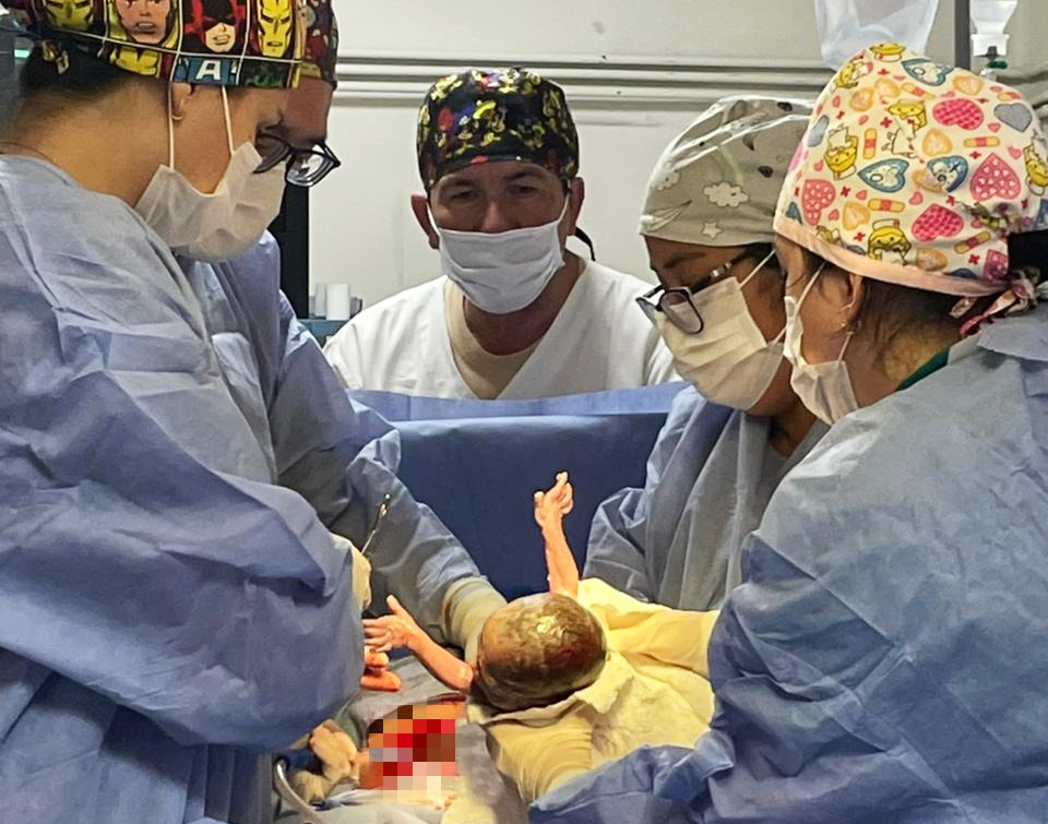 Nacimiento de trillizos prematuros en el Hospital Central del IPS: un caso de alta complejidad materno -fetal