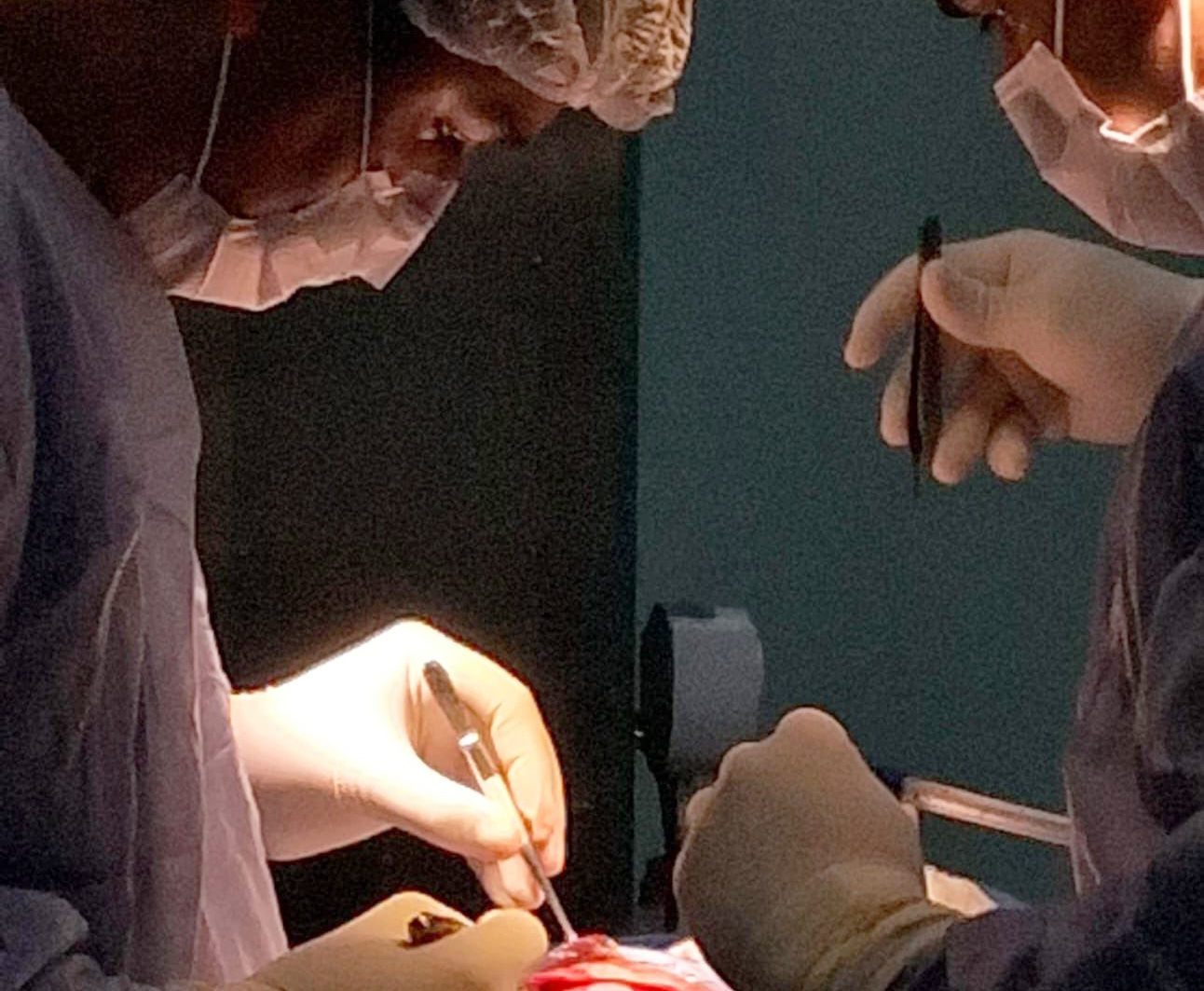 IPS de Ciudad del Este realiza con éxito su primera cirugía de craneosinostosis en una bebé de 5 meses