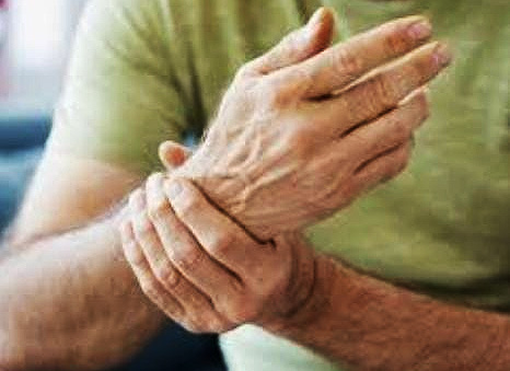 Unos 1.000 casos de esclerosis múltiple son diagnosticados en Paraguay y van en aumento