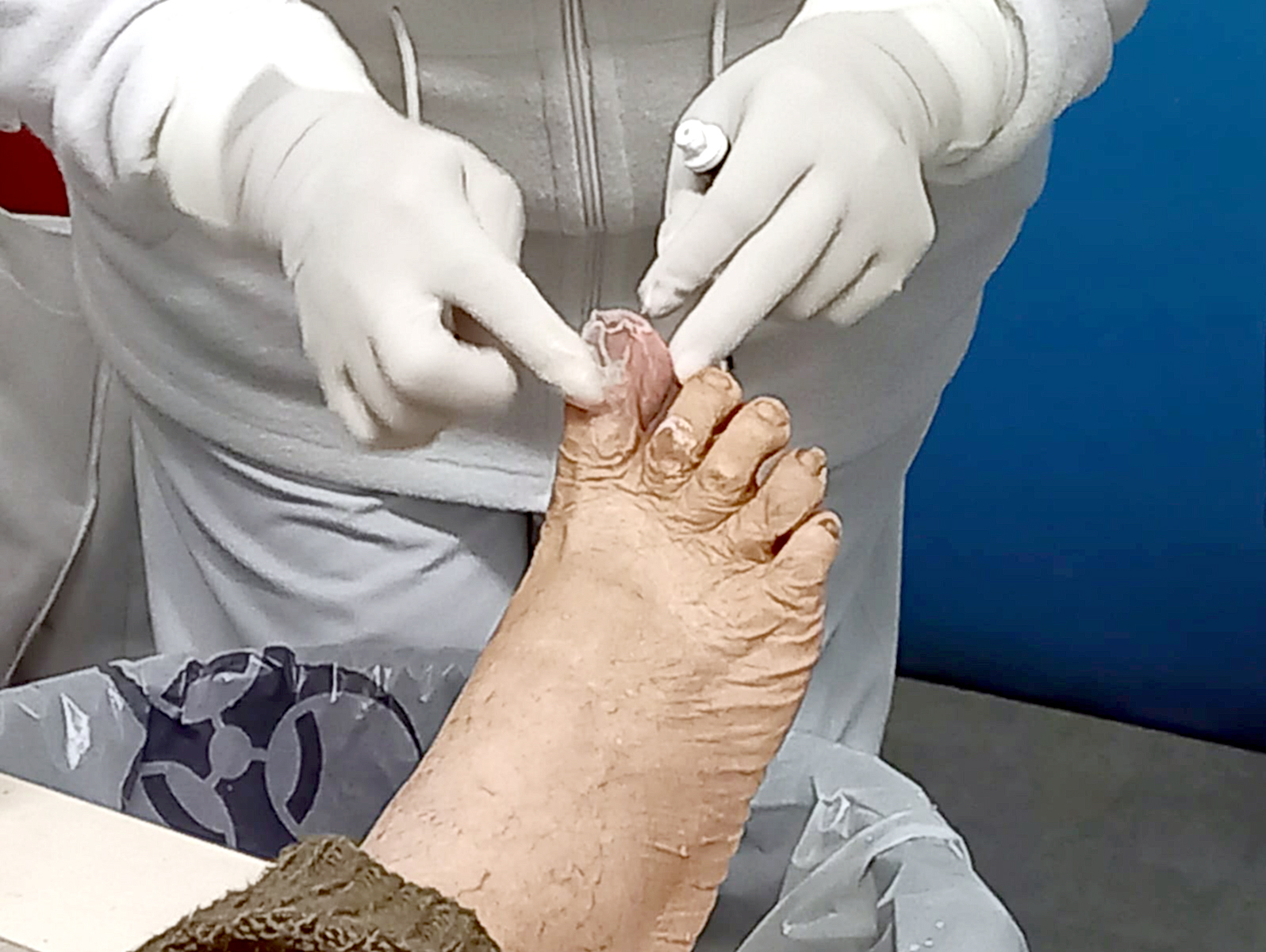 Tratamiento de heridas para pacientes ambulatorios e internados