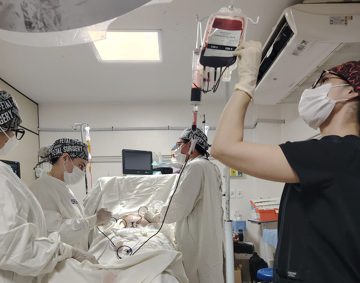 Transfusión intrauterina en gemelos con anemia fetal severa