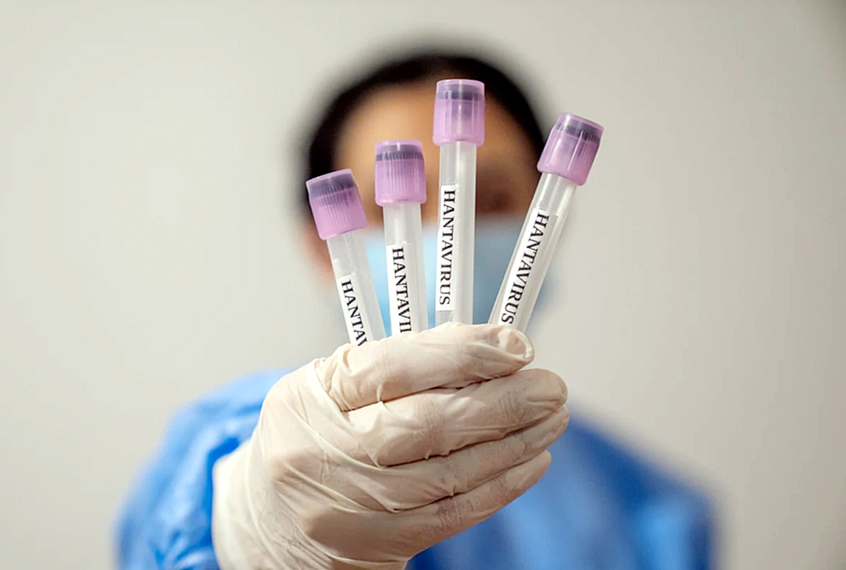 Síntomas iniciales del Hantavirus pueden parecer una gripe común