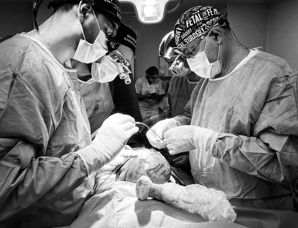 Vigésima Cirugía fetal intrauterina en el Hospital Central del IPS