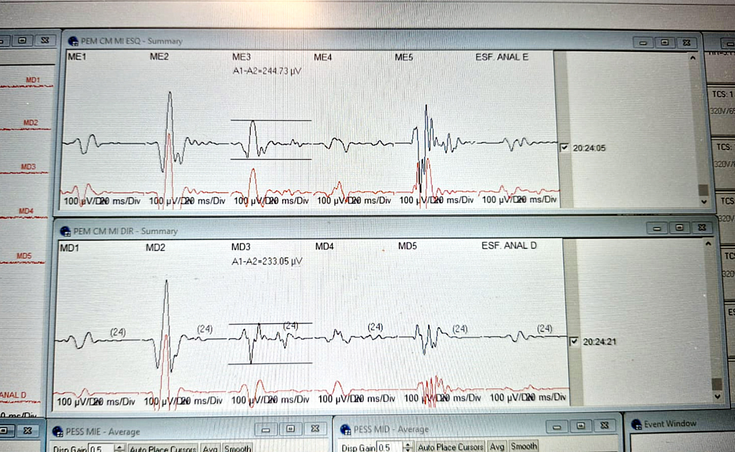 Ingavi fortalece la formación especializada en neuromonitoreo intraoperatorio